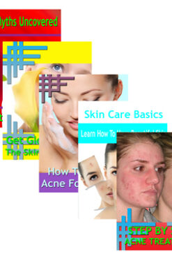 Beating Acne 5 Guides Collection